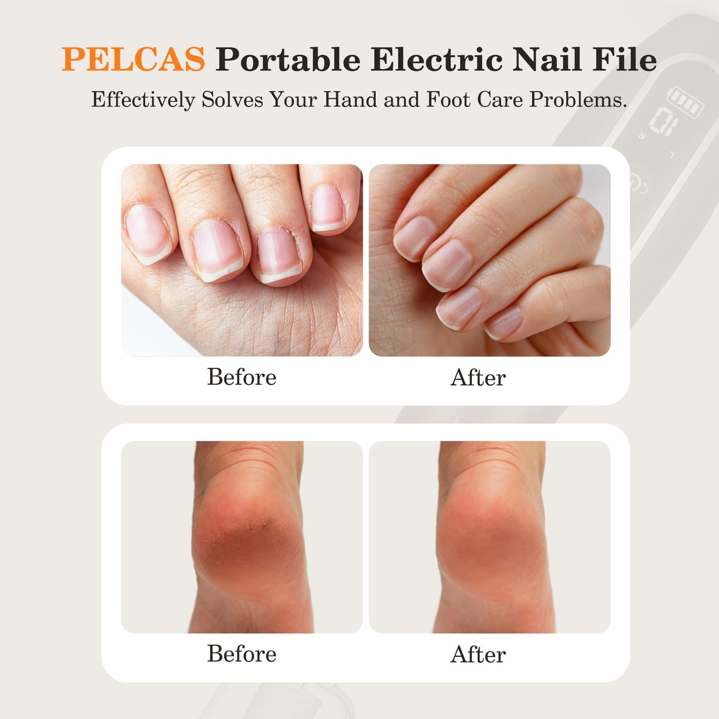 PELCAS Electric Nail Drills, Professional Cordless Nail File Kit with Light, 10 Speeds Manicure & Pedicure Kit for Human, Pet, Thick Toenails, Natural & Acrylic Nails Grey