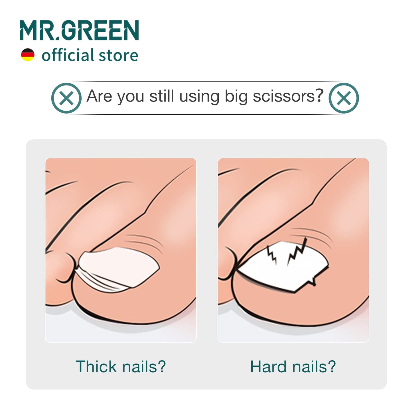 MR.GREEN Toenail Clipper Stainless Steel Ingrown Nail Cutter Good at Cutting Thick and Hard Nails Pedicure Tools (Black)