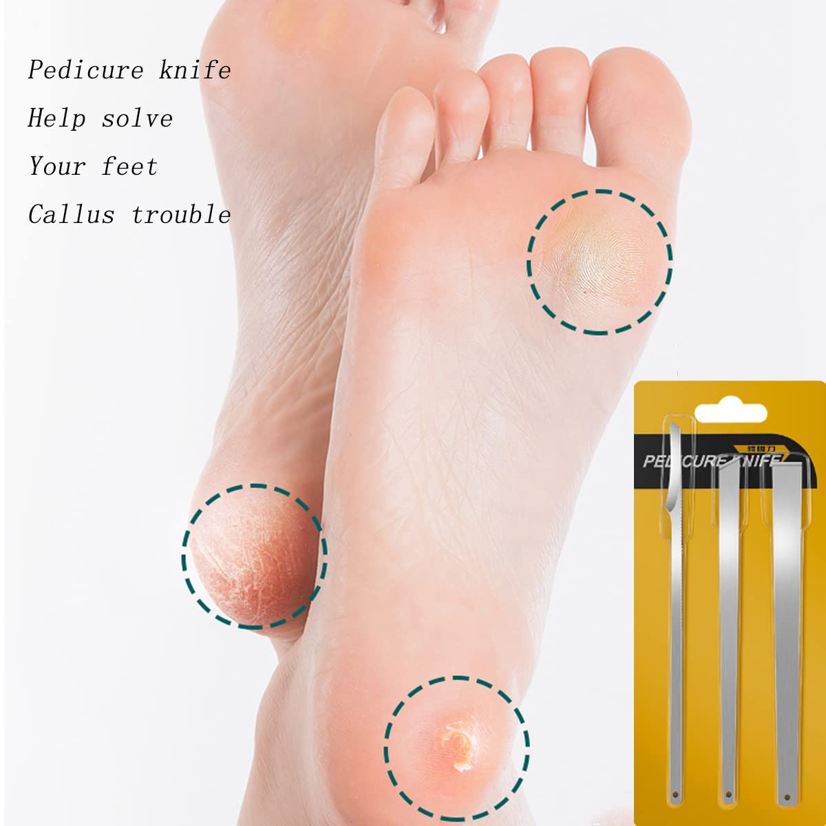 3PCS Stainless Steel ingrown toenail Pedicure Knife Set, Professional Foot Skin Scraper Repair Sharp Blade kit for Nail Corn Callus Paronychia Treatment (with Holes)