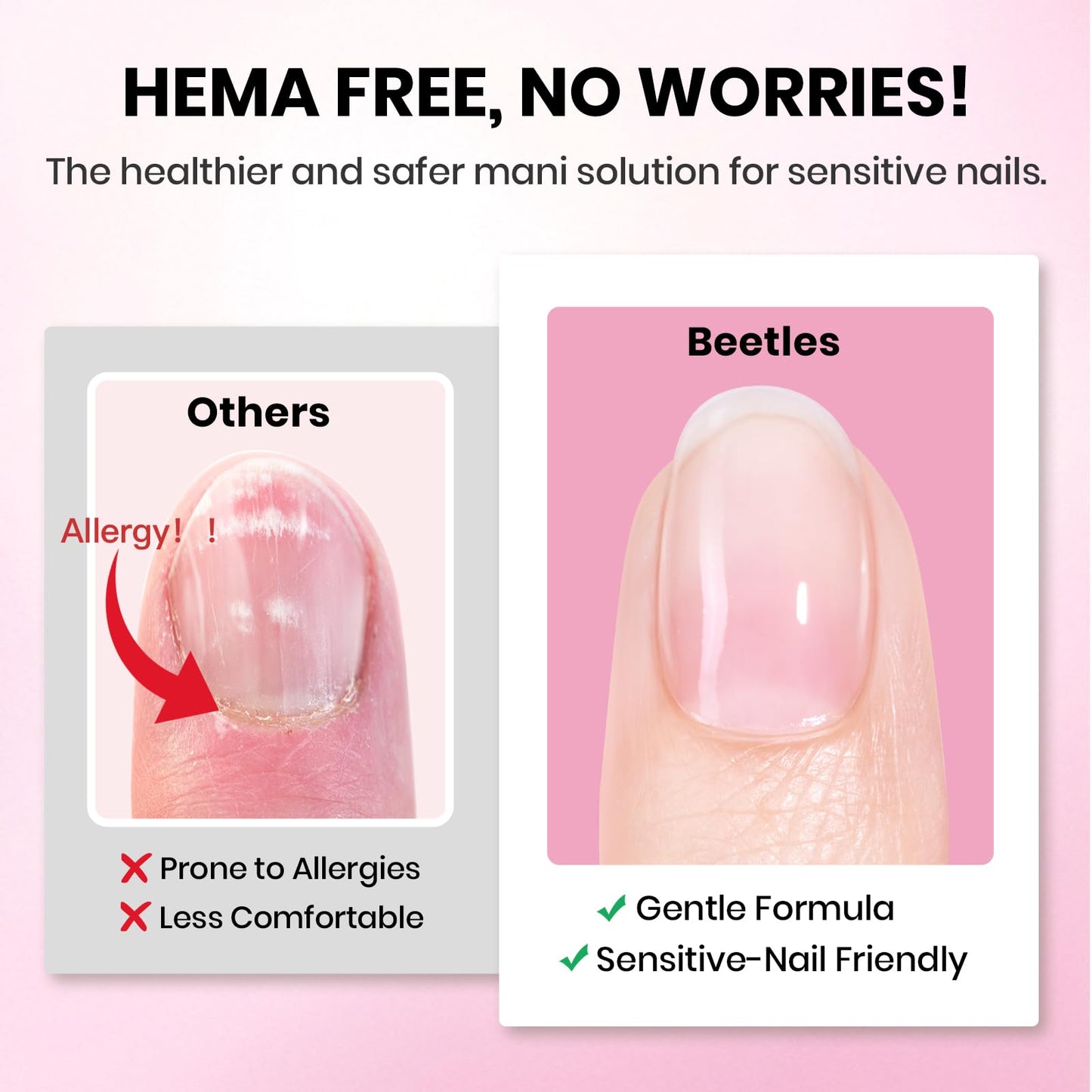 Beetles Gel Nail Kit Etch-X, Almond Short, 288pcs 12 Sizes Nail Tips, 3Pcs 15ml HEMA-Free Nail Glue Top Coat & Base Gel Set, with Mini Lamp, Press On Nail, Long Lasting Extension DIY Set at Home