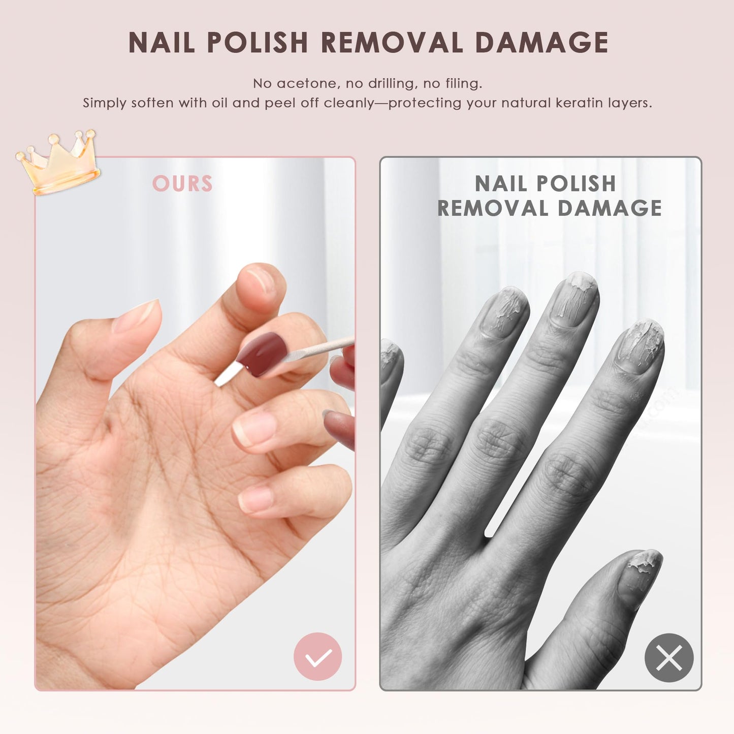 KHARITA Semi Cured Gel Nail Strips – Real Gel Nail Polish Wraps for Brittle Nails | Waterproof Long Lasting Easy Peel-Off Removal | Hema-Free | 20-Piece Pink Ombre Salon Kit with UV Lamps