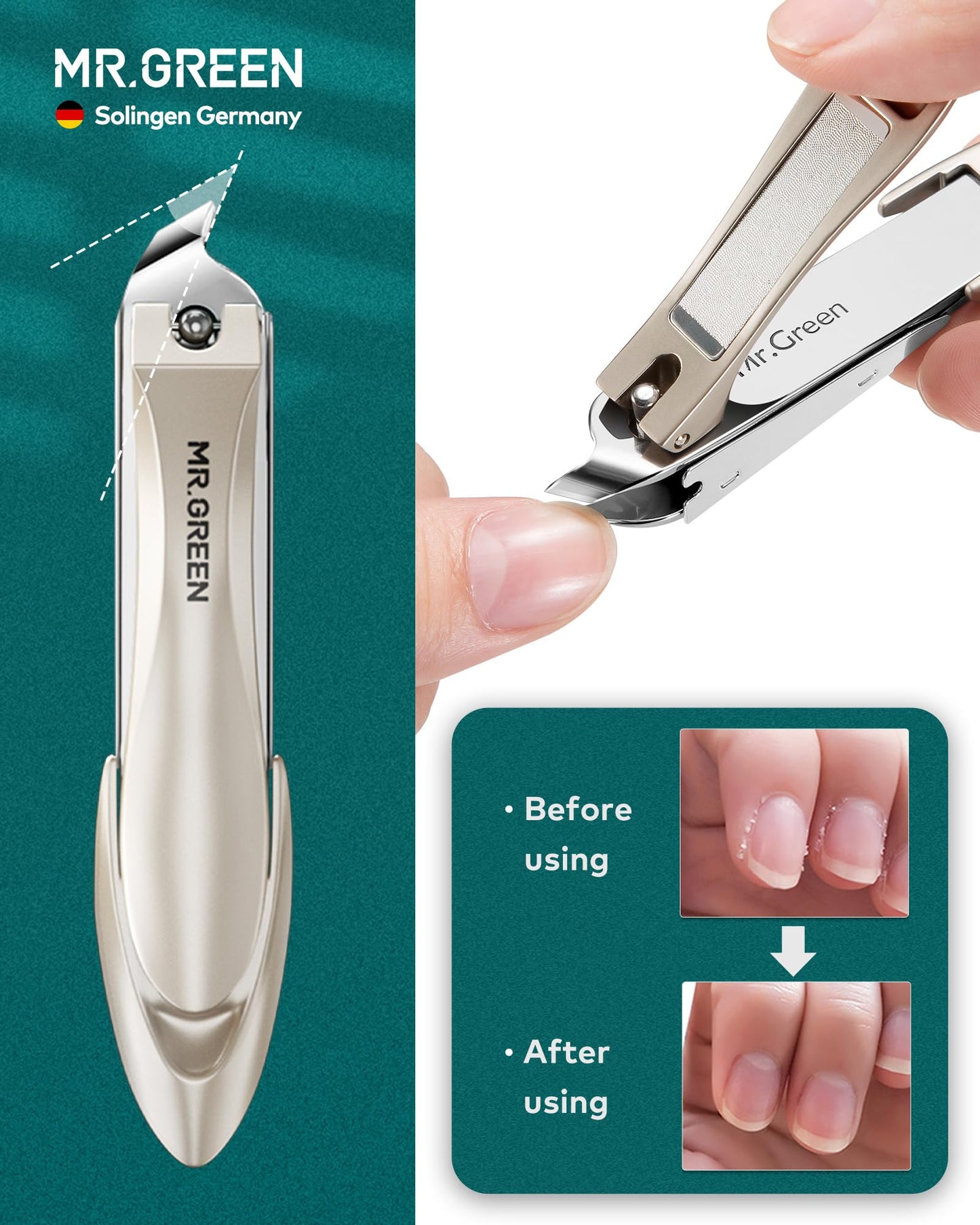 MR.GREEN 3pcs Nail Clippers Set, German Stainless Nail Clippers with Nail File, Anti Splash Excellent Quality Nail Cutters, Professional Finger&Toenail Clippers with Exquisite Case for Men& Women